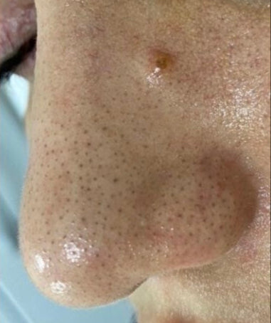1. Clogged Pores = Wasted Skincare